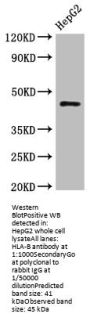 HLA-B Antibody