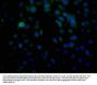 HLA-B Antibody