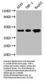 HLA-B Antibody