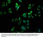 HLA-B Antibody