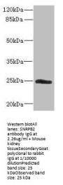 SNRPB2 Antibody