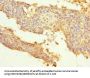 SNRPB2 Antibody