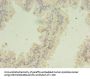 SNRPB2 Antibody