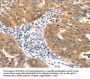 TPM2 Antibody