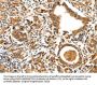 TPM2 Antibody