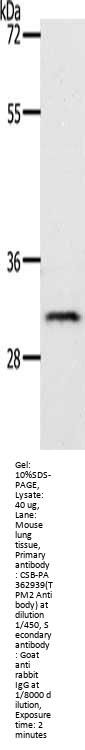 TPM2 Antibody