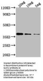 GLMU Antibody