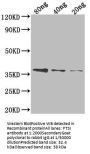FTSI Antibody