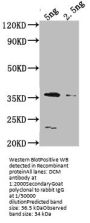DCM Antibody