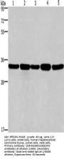 Rabbit anti-human E2F6 polyclonal antibody