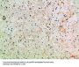 ASIC1 Antibody