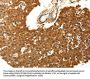 SKP1 Antibody