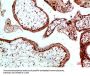 UBB/UBC/RPS27A/UBA52 Antibody