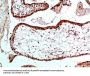 UBB/UBC/RPS27A/UBA52 Antibody