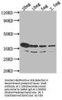 btuB Antibody