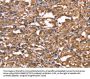 TDP2 Antibody
