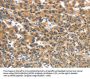 UBTD2 Antibody