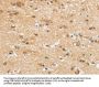 UBTD2 Antibody