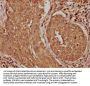 TRABD2B Antibody