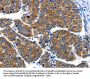 IGF2BP1 Antibody