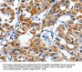 IGF2BP1 Antibody