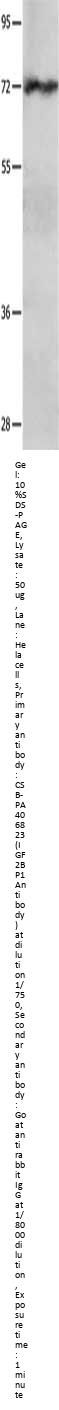 IGF2BP1 Antibody