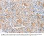 MYC Antibody