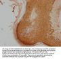 LRRC3C Antibody