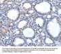 HCN1 Antibody