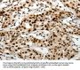 Rabbit anti-human SCN1A polyclonal antibody