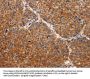 TIMP2 Antibody