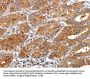 TIMP2 Antibody