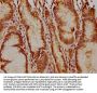 USP17L5 Antibody