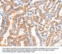 SCNN1A Antibody