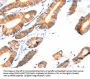 SCNN1A Antibody