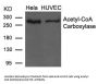ACACA (Ab-79) Antibody