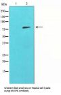 MMP9 Antibody