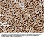 SSB Antibody