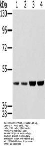 SSB Antibody