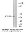 KCNK1 Antibody