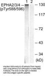 Phospho-EPHA2/EPHA3/EPHA4 (Tyr588/596) Antibody