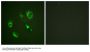 Phospho-EPHA2/EPHA3/EPHA4 (Tyr588/596) Antibody