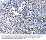 IGFBP7 Antibody
