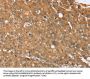 NOS2 Antibody