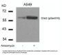 Phospho-CHEK2 (Ser516) Antibody