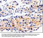 ABCG2 Antibody
