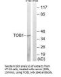 TOB1 (Ab-164) Antibody