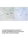 TOB1 (Ab-164) Antibody