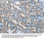 IL21R Antibody