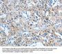IL21R Antibody